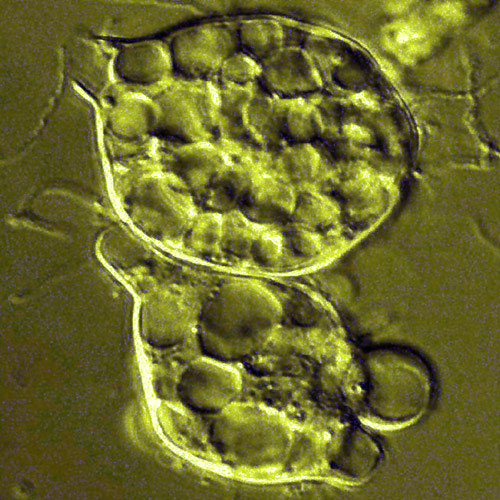 Batrachochytrium dendrobatidis